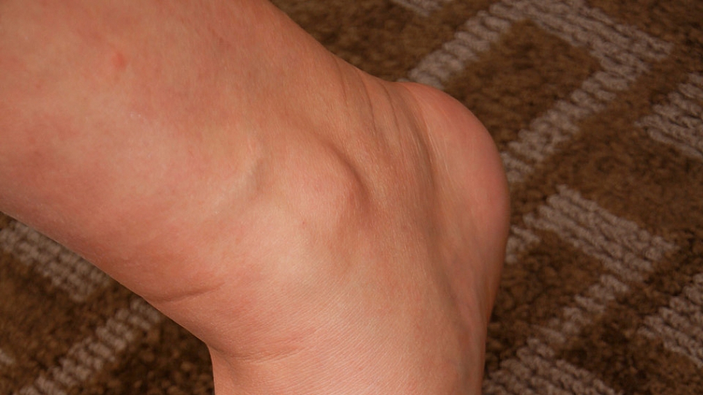 The Breath Taking Lexi Barbie